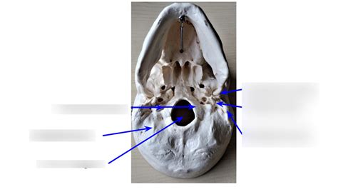 The Skull Bone And Bone Markings Inferior View Diagram Quizlet