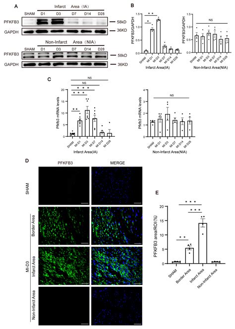 PFKFB3 Inhibitor 3PO Reduces Cardiac Remodeling after Myocardial