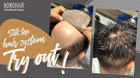 Before And After A Hair Replacement System For Men Hair System