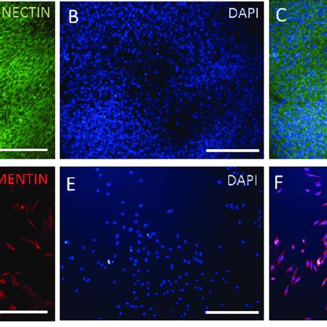 G Banding Analysis For Yhff Cell Lines Indicated The Normal Karyotype Download Scientific