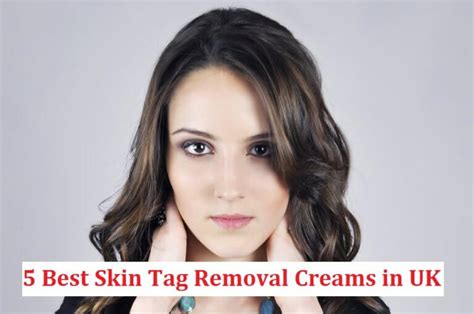 5 Best Skin Tag Removal Cream UK (Reviews & Comparison)