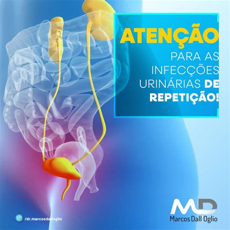 Infecção Urinária De Repetição O Que Pode Ser - Infecções Urinárias De Repetição Infecções Urinárias – TMBI
