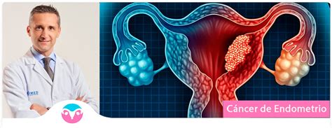 ⭐ Especialista Cáncer De Endometrio Valencia Dr Lucas Minig