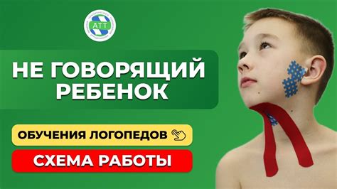 Аллалия. Неговорящий ребенок. Тейпирование в логопедии. - YouTube