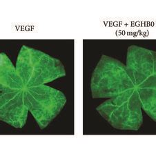 Eghb Inhibits Vegf Induced Retinal Vascular Leakage A