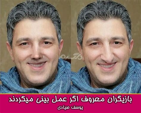 بازیگران معروف اگر عمل بینی میکردند چه شکلی میشدند