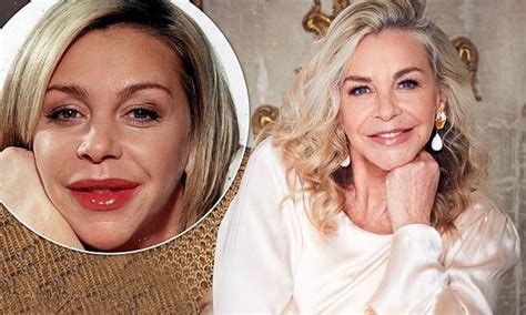 Leslie Ash, 61, sends out a warning to those considering lip fillers ...