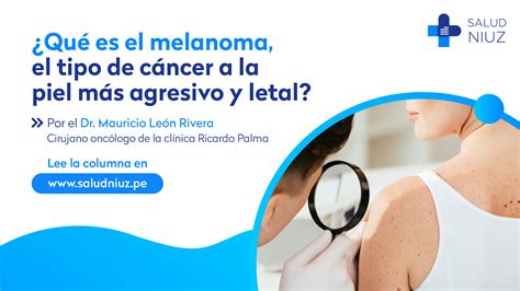 Qu Es El Melanoma El Tipo De C Ncer A La Piel M S Agresivo Y Letal