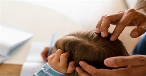 Head Lice What Parents Need To Know