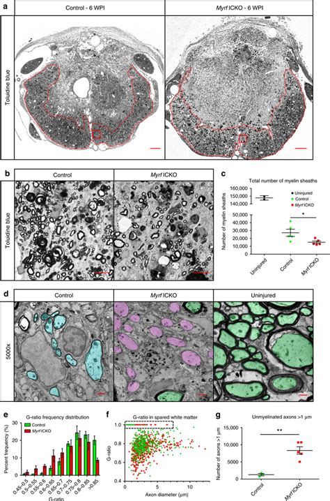 Chronic Demyelination Of Spared Axons In Myrf Icko Six Weeks Following