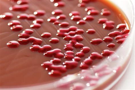 Serratia marcescens antibiotics