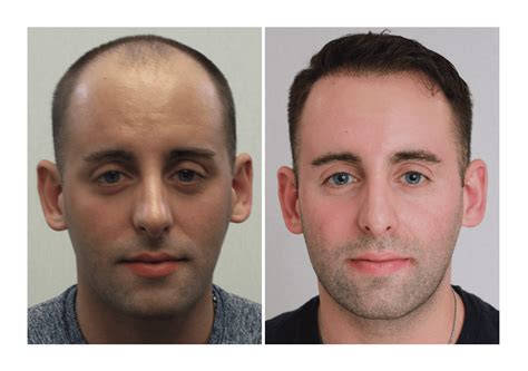 Jw Woodward: Before & After Results That Will Shock You Image 14