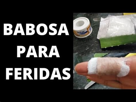 Babosa Na Ferida - Babosa para feridas - YouTube