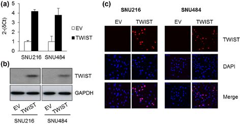 Twist Mediates Resistance To Paclitaxel By Regulating Akt And Bcl 2 Expression In Gastric Cancer