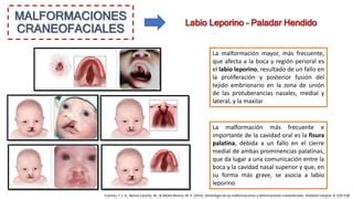 Malformaciones Congénitas | PPTX