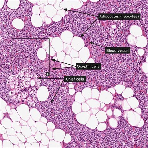 Normal Parathyroid Gland Histology Slides Anatomy And Physiology