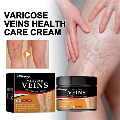 Promo South Moon Varicose Veins Cream G Vein Cure Cream Anti