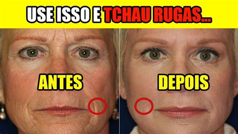 Rugas No Rosto Como Tirar - Veja Como Tirar As Rugas E Manchas No Rosto Usando Pó Royal! Como ...