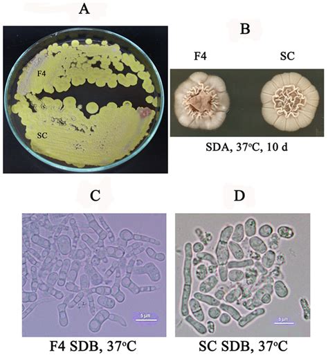 Morphology Of P Marneffei Atfa Mutant Compared With Wild Type