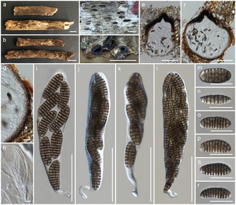 Phaeoseptum Thailandicum Facesoffungi Number FoF 11798 Faces Of Fungi