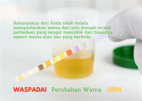 Waspadai Perubahan Warna Urin Anda Yuk Cari Tahu Bahayanya