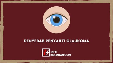 Penyebab Penyakit Glaukoma Pengertian Gejala Dan Jenisnya