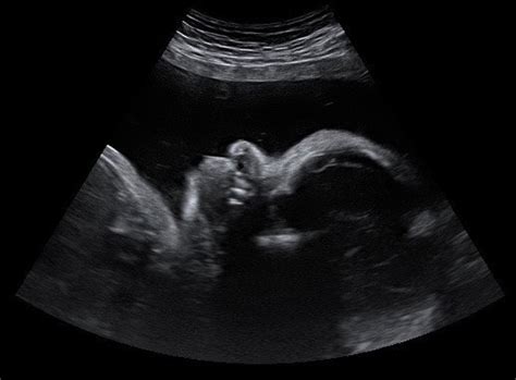 Precious Glimpse Ultrasound - Augusta