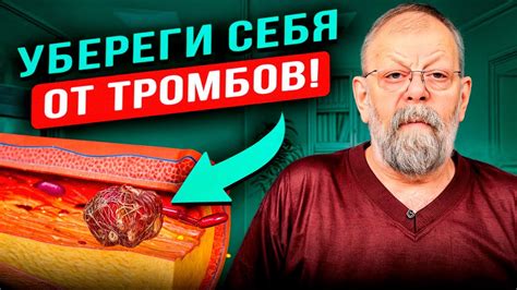 Продукты питания и тромбоз вен. Доктор медицинских наук. - YouTube