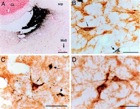 A) Photomicrograph of a coronal section counterstained with neutral red ...