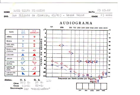 Audiometria Vocal E Tonal - Como interpretar o resultado da audiometria - parte 1 – Lak Lobato