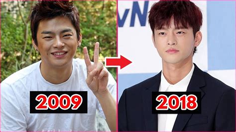 Seo In Guk Before And After Plastic Surgery ABTC