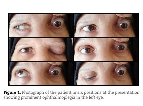 Photograph Of The Patient In Six Positions At The Presentation Showing Download Scientific