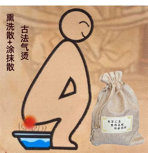 Traditional Chinese Medicine Anal Hemorrhoid Sitz Bath Powder Anal Cream Hemorrhoid Cream Anal