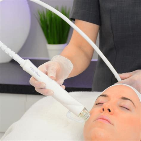 Does Rf Microneedling Tighten Skin Nikki Butler Skin Specialist In Hampshire