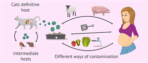 Toxoplasmosis