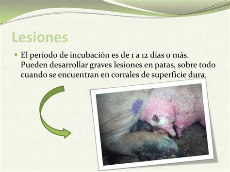 Fiebre Aftosa