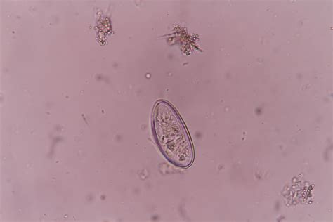 Острицы Фото Под – Telegraph