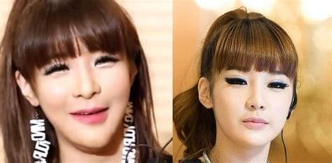 Park Bom Plastic Surgery Before And After Photos