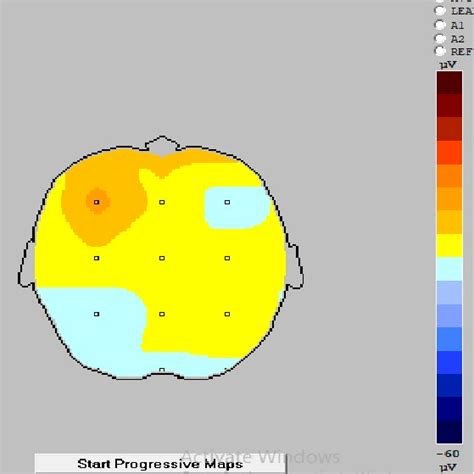 Visual stimulus -Single map. | Download Scientific Diagram