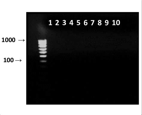 Electroforesis En Gel De Agarosa Al 1 De Los Productos RT PCR Con