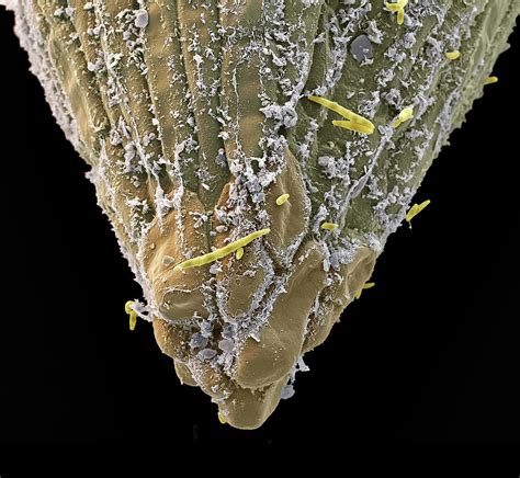 Fusarium Oyxsporum Sem Photograph By Oliver Meckes EYE OF SCIENCE