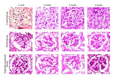 Renal Pathological Changes Of The Different Groups At Different Time