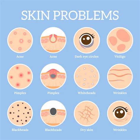 Scaly red spots on skin. 22 Common Skin Rashes: Causes, Symptoms, and ...