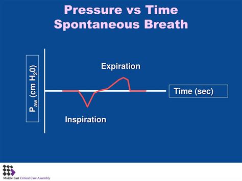 PPT Basic Pulmonary Mechanics During Mechanical Ventilation