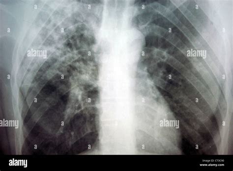 Baghdad Boil Hi Res Stock Photography And Images Alamy