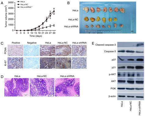 Knockdown Of HnRNP A2 B1 Inhibits Cell Proliferation Invasion And Cell