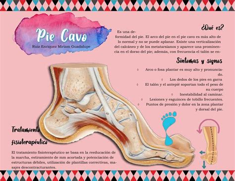 pie cavo miriam guadalupe ruiz enriquez udocz