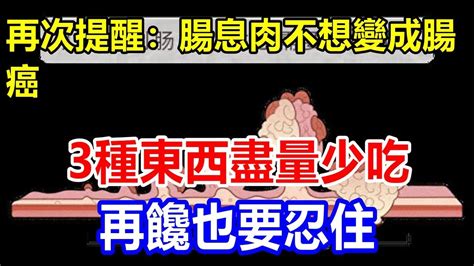 再次提醒：腸息肉不想變成腸癌，3種東西盡量少吃，再饞也要忍住 Youtube