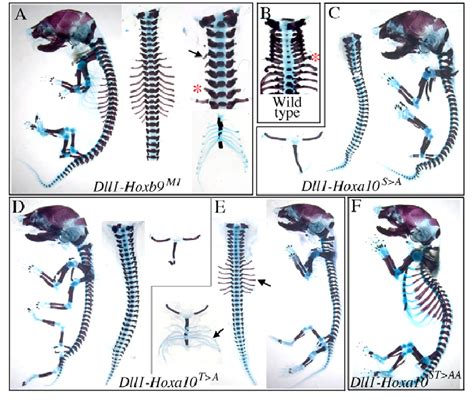 Skeletal phenotypes of transgenic mice expressing different mutant and ...
