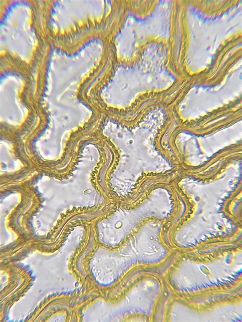 Using my microscope to look at a Sphagnum austinii leaf : r/Sphagnum